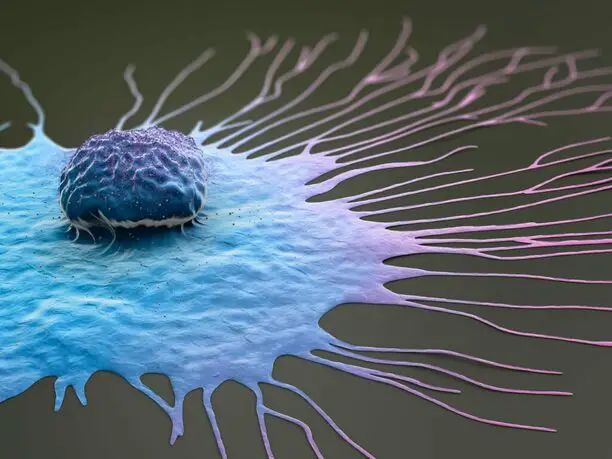 خلية سرطان الثدي